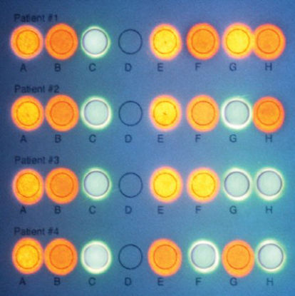 Picture of Student Lab Activity Edvotek™ DNA/RNA MicroarrayS05648