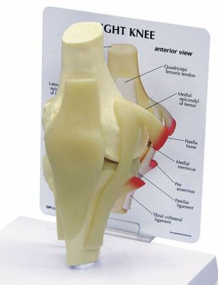 Picture of Basic Knee Model Galloway Plastics Full-Size 2 lbs.SB35430