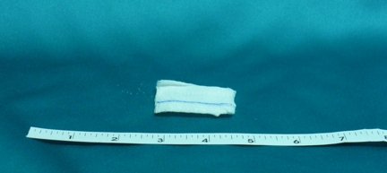 Picture of X-Ray Detectable Gauze Sponge Bioseal® Cotton 12-Ply 2 X 2 Inch Square Sterile7320/50