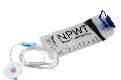 Picture of Irrigation Delivery Kit Cardinal Health™47-6500