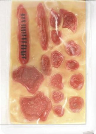 Picture of Stick on Wounds800-219