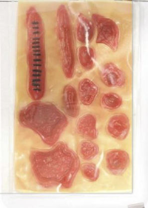 Picture of Stick on Wounds800-219