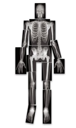 Picture of True-to-Life Human X-Rays™  Roylco®SB40317