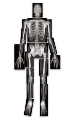 Picture of True-to-Life Human X-Rays™  Roylco®SB40317