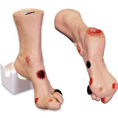 Picture of Wilma Wound FootSB46503