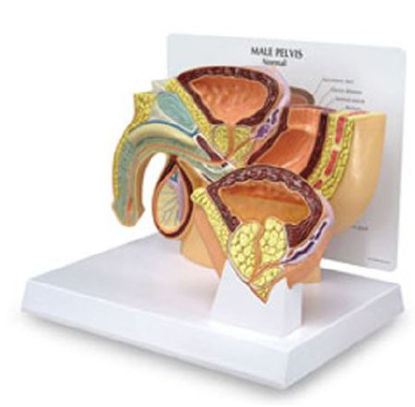 Picture of Male Pelvis BPH Model MaleSB49529