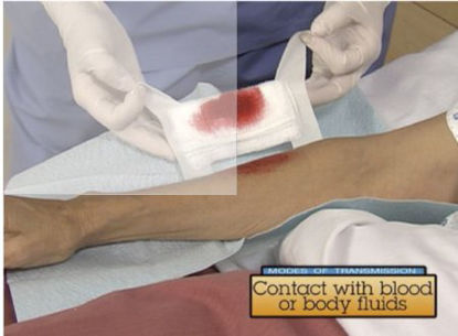 Picture of DVD Infection Control for the Medical Assistant Part 1Z47599