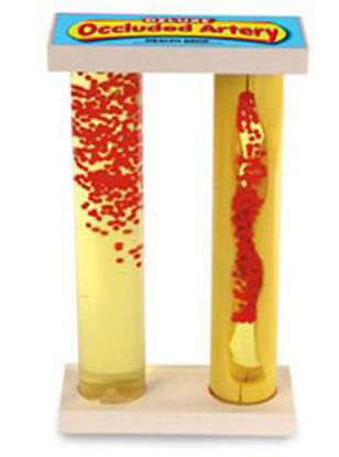 Picture of Occluded Artery Model PlasticSB43034