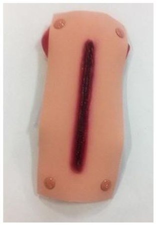 Picture of Lacerated Forearm800-6726