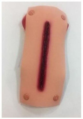 Picture of Lacerated Forearm800-6726