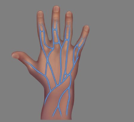 Picture of DVD_Routine Care and Discontinuation Intravenous TherapyZ47038