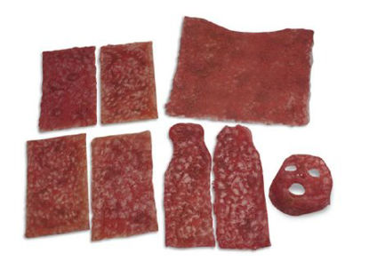 Picture of Simulated Burns Complete Set Life/Form®LF00729