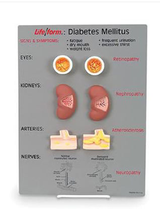 Picture of Diabetes Mellitus Teaching Kit Life/form®WA20495