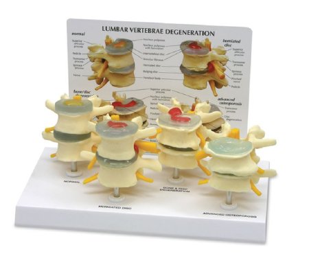 Picture of 4 Stage Vertebrae Model GPI Anatomicals®SB35468