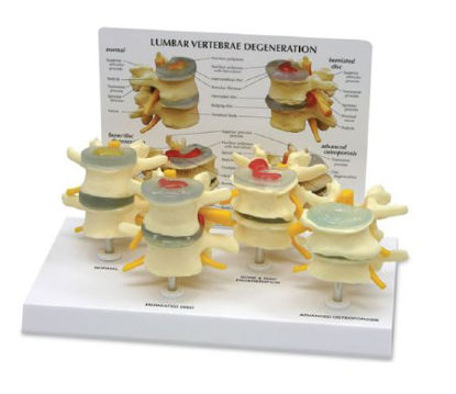 Picture of 4 Stage Vertebrae Model GPI Anatomicals®SB35468