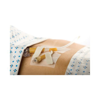 Picture of Catheter Holder Cath-Secure Dual Tab® 3 Inch Wrap Tabs x 3 Inch Wide Base5445-4