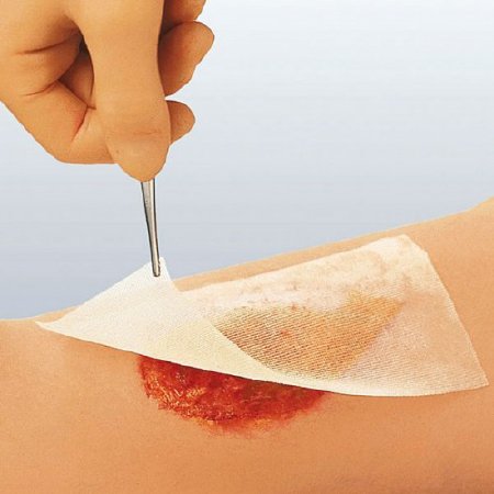 Picture of Impregnated Dressing Cuticerin 4 X 4 Inch Acetate Gauze Cuticerin Ointment Sterile66045564