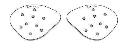 Picture of Eye Protector BD Visitec™ One Size Fits Most581019