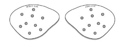 Picture of Eye Protector BD Visitec™ One Size Fits Most581019