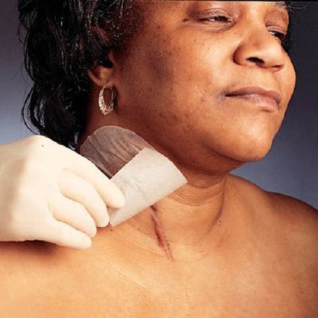 Picture of Silicone Gel Sheeting Mepiform® Silicone Gel 4 X 7 Inch NonSterile929878