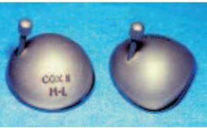 Picture of Laser Eye Protector with Left Handle Small HandleOK21-262HL