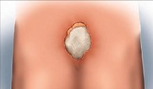 Picture of Hydrogel Dressing GelPad® 8 X 4 Inch SterileMP00012