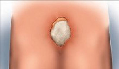 Picture of Hydrogel Dressing GelPad® 8 X 4 Inch SterileMP00012