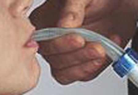 Picture of Feeding Cup Nozzle People Feeder745810010