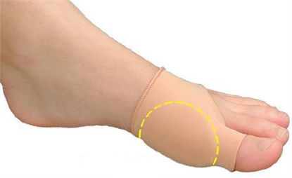 Picture of Bunion Sleeve Visco-GEL® Bunion Care™ Large / X-Large Pull-On Left or Right Foot1307
