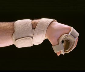 Picture of Wrist / Hand / Thumb Splint Orthosis AliMed® Omni Progressive™ Low Profile Aluminum / Foam / Terry Cloth Right Hand Beige Standard510741/NA/NA/RT