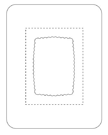 Picture of Transparent Film Dressing with Pad SorbaView® 2000 Rectangle 5 X 6-1/2 Inch Frame Style Delivery Without Label SterileSV80XT
