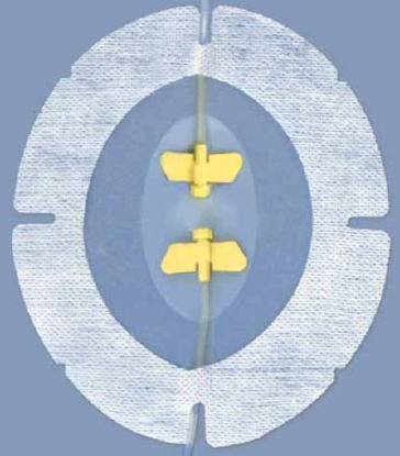 Picture of I.V. Specialty Dressing SecureView Film 5-1/2 X 6-1/2 Inch SterileSCVP66XT