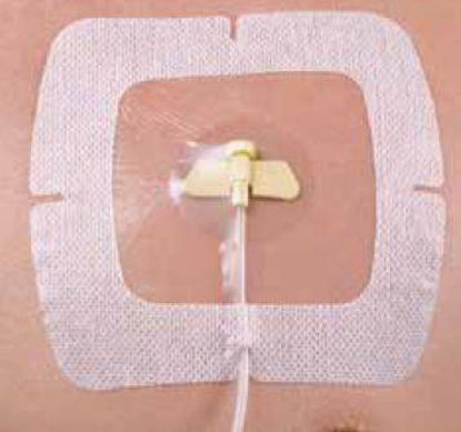 Picture of I.V. Specialty Dressing SecureView Film 5-1/2 X 6-1/2 Inch SterileSCP66VXT