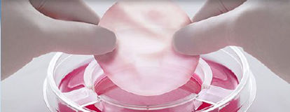 Picture of Skin Repair Therapy Apligraf®11USCOM01