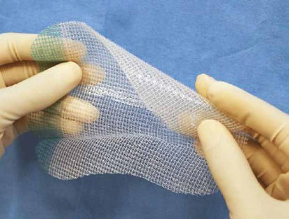 Picture of Self-Fixating Hernia Repair Mesh ProGrip™ Partially Absorbable Knitted Polyester Monofilament / Polylactic Acid (PLA) 10 X 15 cm Rectangle Style SterileLPG1510X2