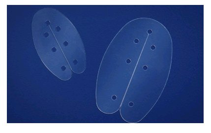 Picture of Internal Nasal Splint Bivalve Splint Plastic OversizeSP-27015