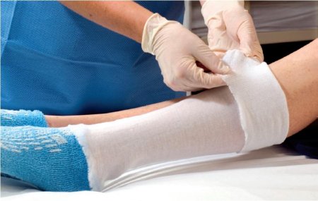 Picture of Stockinette Tubular Albahealth® 2 Inch X 25 Yard Synthetic86212