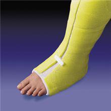 Picture of Starter Set CastWedge™64740