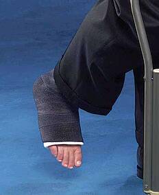 Picture of Cast Tape Delta-Cast® Elite 2 Inch X 12 Foot Polyester White6712