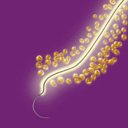 Picture of Antibacterial Suture with Needle Coated Vicryl™ Plus Absorbable Coated Undyed Suture Braided Polyglactin 910 with Irgacare MP Antibacterial Suture Size 4 - 0 27 Inch Suture 1-Needle 19 mm Length 3/8 Circle Precision Point - Reverse Cutting NeedleVCP426H