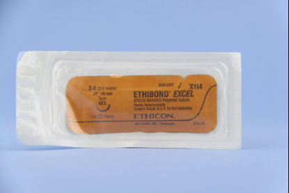 Picture of Suture with Needle Ethibond Nonabsorbable Coated Green Suture Braided Polyester Size 2 - 0 27 Inch Suture 1-Needle 14 mm Length 1/2 Circle Taper Point NeedleX114H