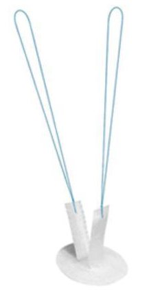 Picture of Ventral Hernia And Fascial Deficiencies Repair Mesh Proceed™ Ventral Patch (PVP™) Partially Absorbable Polypropylene Monofilament Encapsulated with Polydioxanone ( PDS ) / Oxidized Regenerated Cellulose (ORC) Fabric / Polydioxanone ( PDS ) 4.3 X 4.3 cm Small Style Undyed with Blue Striping @#$STERILITY_ATTR$#@PVPS