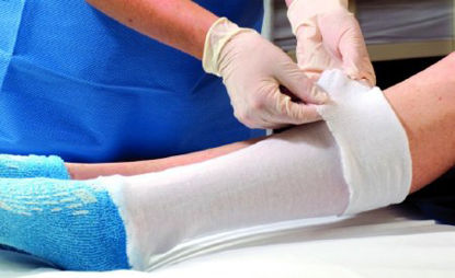 Picture of Stockinette Tubular Albahealth® 3 Inch X 25 Yard Synthetic86312