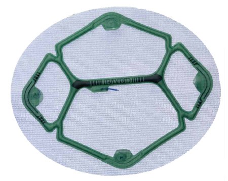 Picture of Laparoscopic Ventral Hernia Repair Mesh Ventralight™ ST with Echo PS™ Positioning System Nonabsorbable Polypropylene Monofilament 6 X 8 Inch Elliptical Style5955680