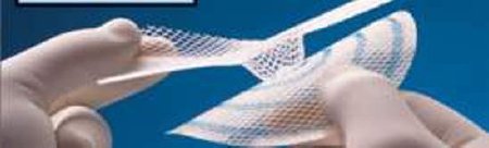 Picture of Hernia Repair Mesh Ultrapro™ Hernia System Partially Absorbable Polypropylene / Poliglecaprone-25 4 X 4 Inch Large Style Undyed with Blue Striping SterileUHSL