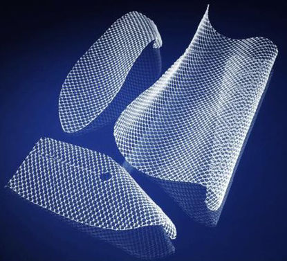 Picture of Inguinal Hernia Repair Mesh Bard® Soft Mesh Nonabsorbable Polypropylene Monofilament 2 X 4 Inch Rectangle Style White Sterile0117008