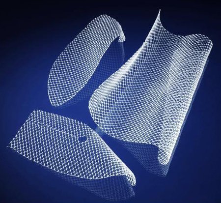 Picture of Inguinal Hernia Repair Mesh Bard® Soft Mesh Nonabsorbable Polypropylene Monofilament 6 X 6 Inch Square Style Sterile0117011