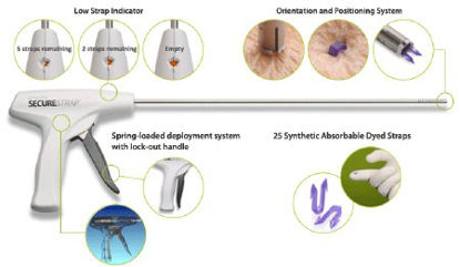 Picture of Laproscopic Fixation Device SECURESTRAP™ Pistol Grip Handle Polymer Blend Strap Absorbable StrapsSTRAP25