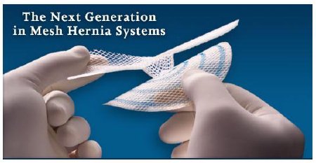Picture of Hernia Repair Mesh Ultrapro™ Hernia System Partially Absorbable Polypropylene / Poliglecaprone-25 3 X 3 Inch Medium Style Undyed with Blue Striping SterileUHSM