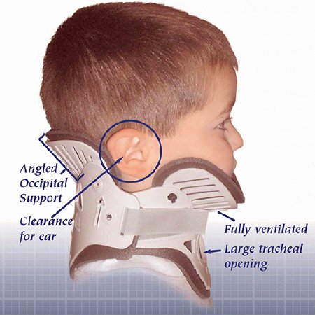 Picture of Rigid Cervical Collar NecLoc® Preformed Infant (0 to 24 Months) Size P1 Two-Piece / Trachea OpeningNL-P1